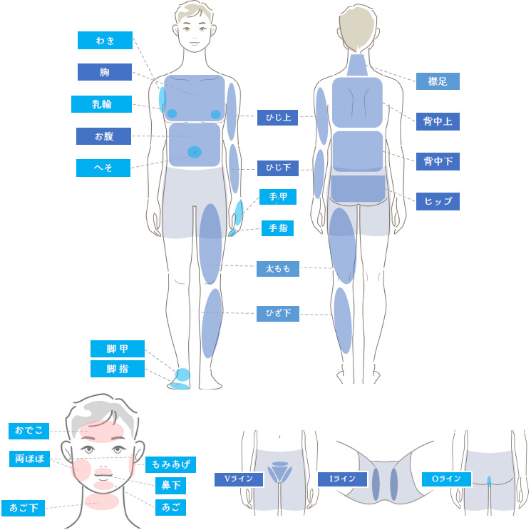 男性 脱毛部位イラスト