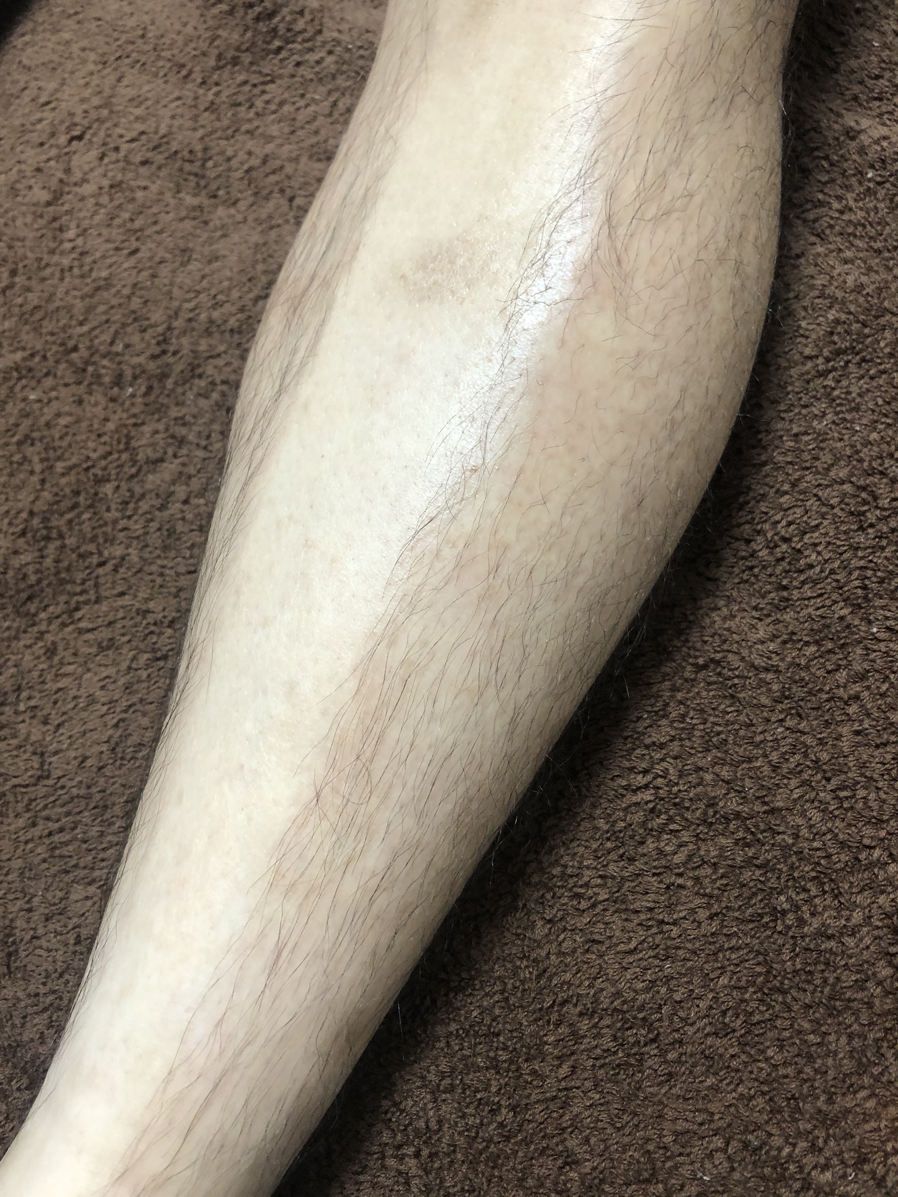 メンズ ひざ下 wax脱毛