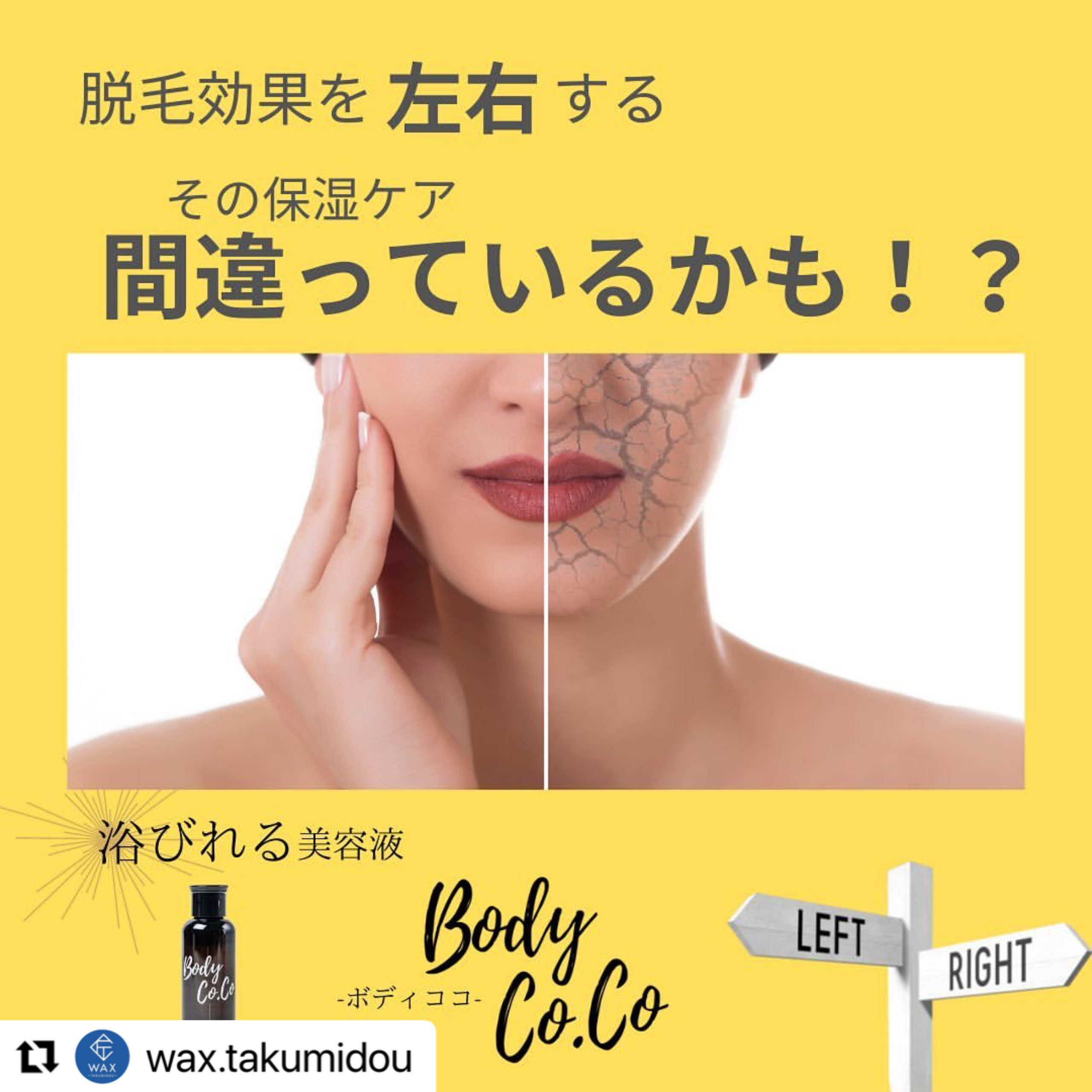 脱毛後の重要ケア!