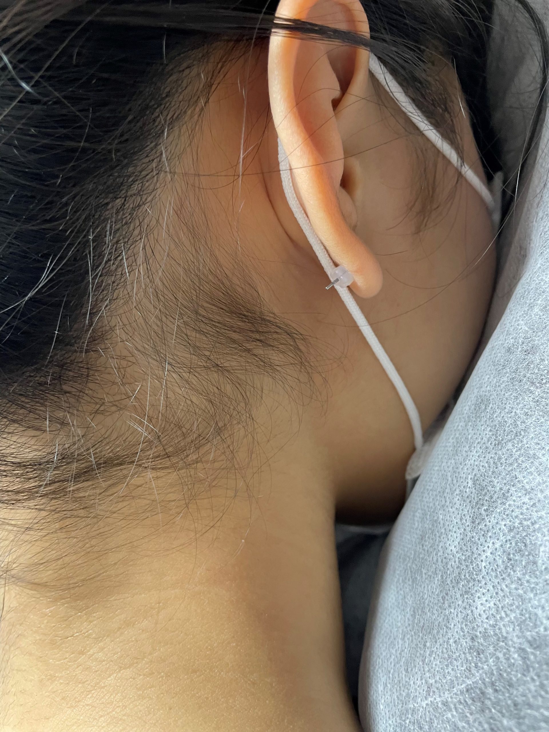 うなじ wax脱毛
