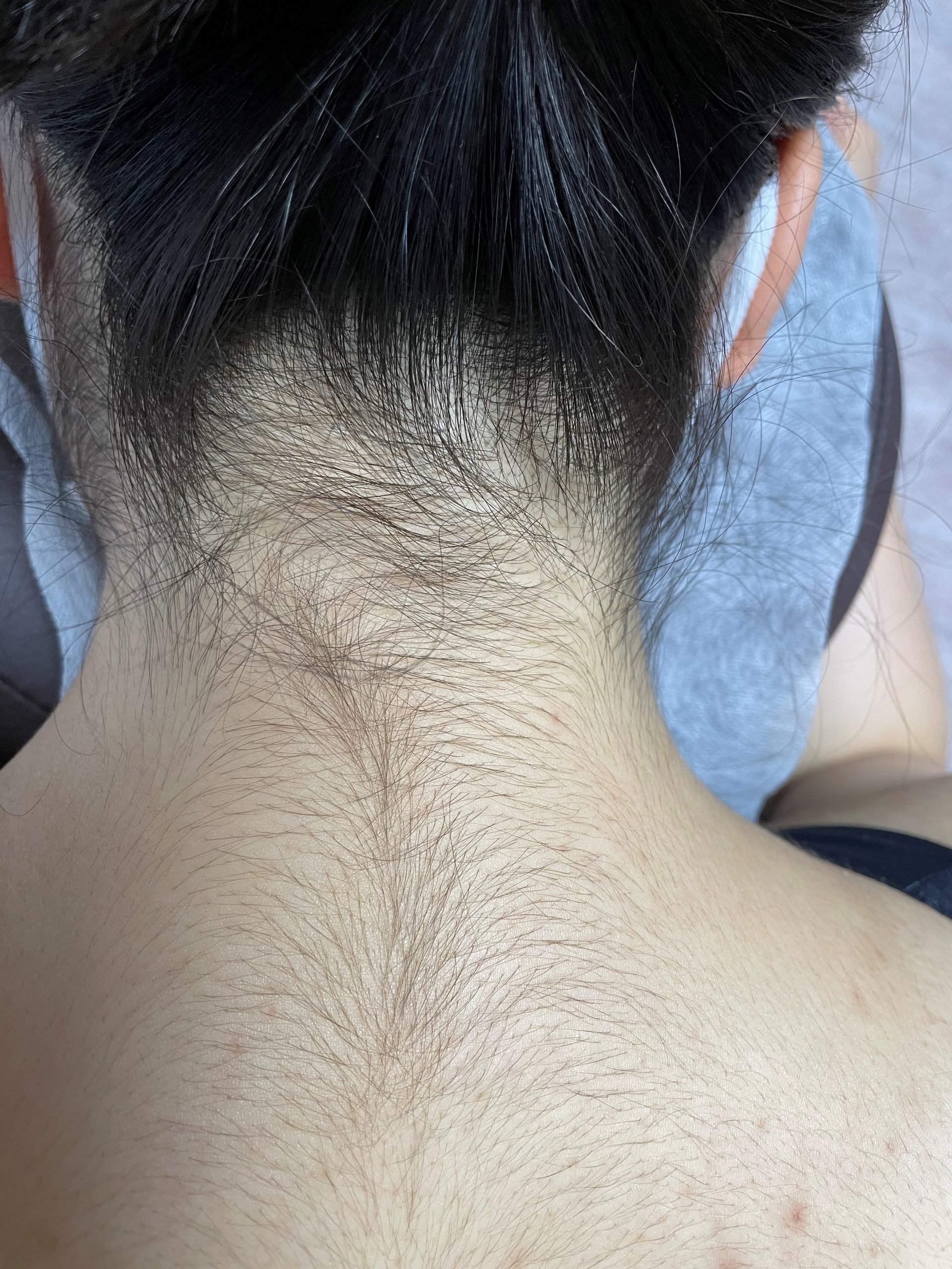 うなじ wax脱毛