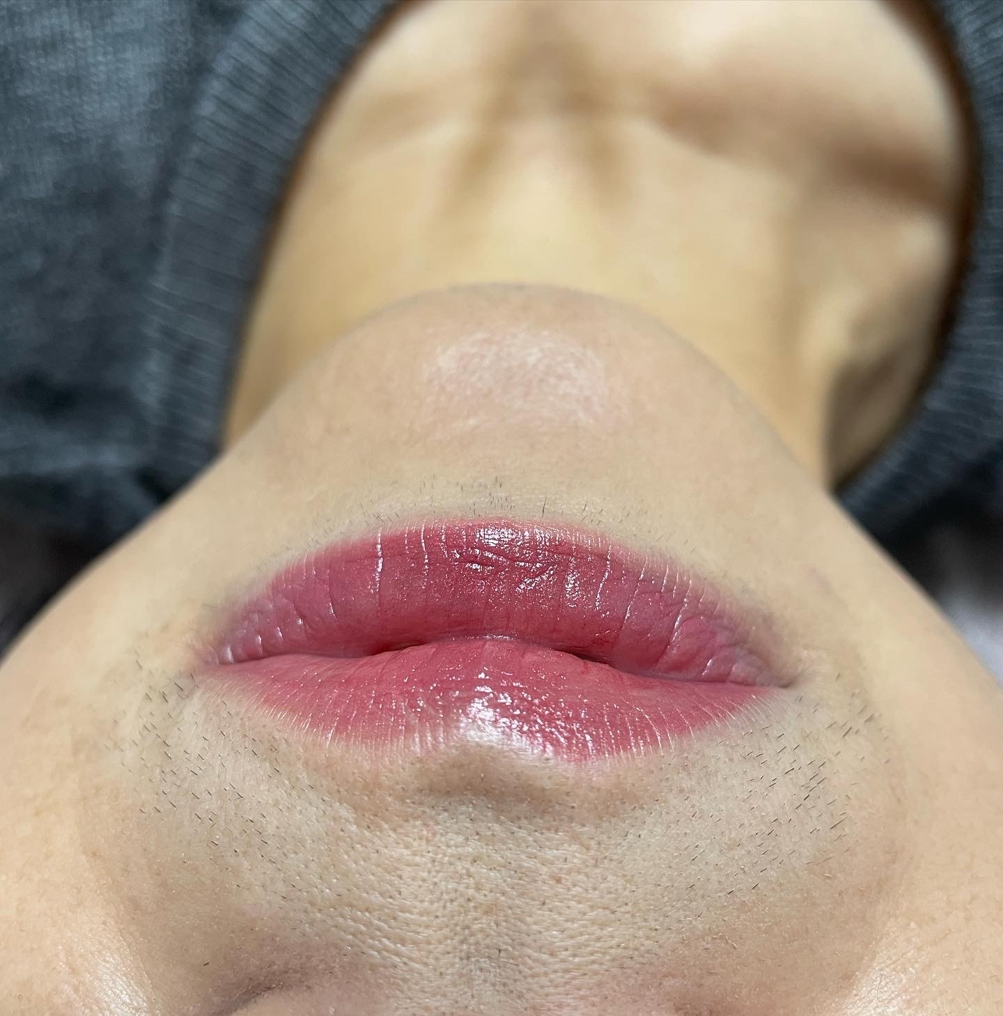 口周り wax脱毛