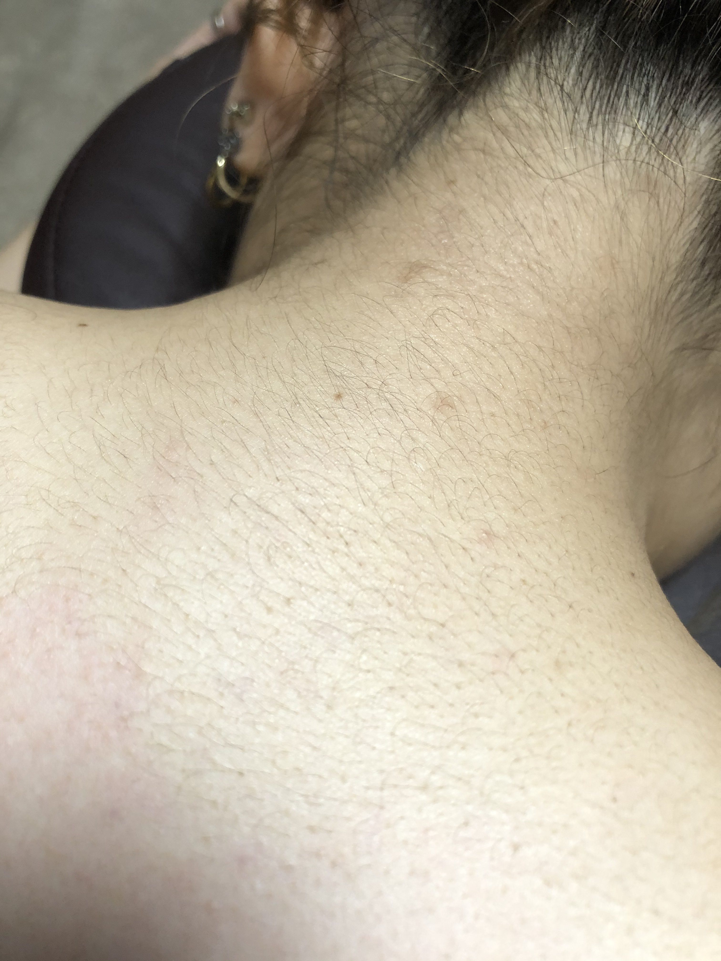 うなじ wax脱毛