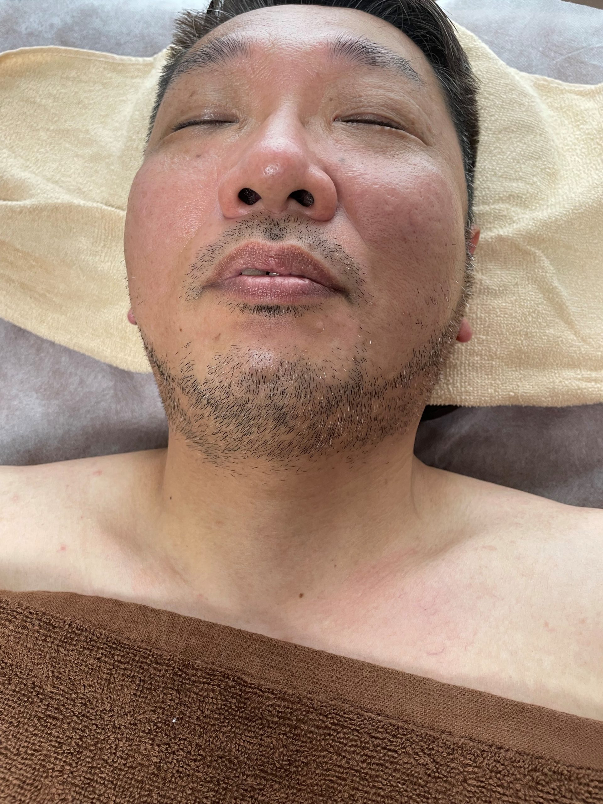 メンズ ヒゲall wax脱毛