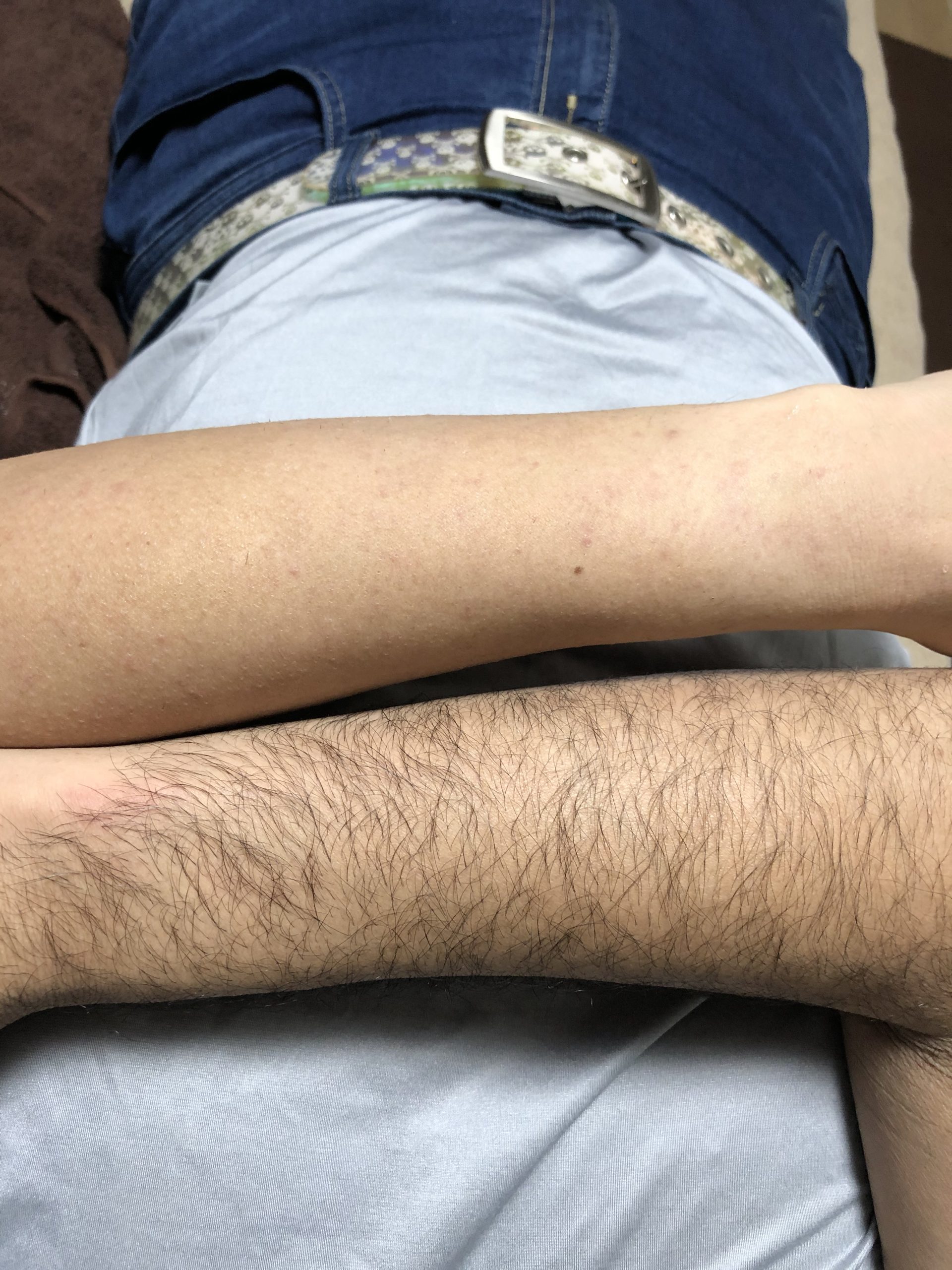 メンズ 腕 wax脱毛